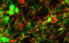 Channelrhodopsin co-expression (green) on tyrosine hydroxlase (red) neurons